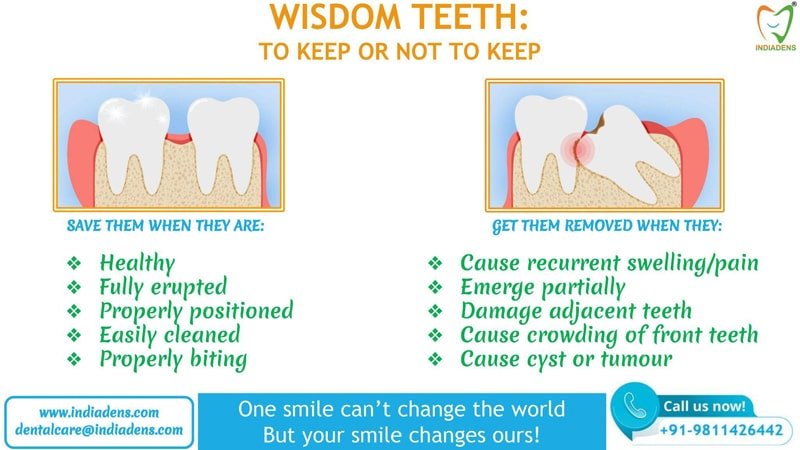 wisdom teeth treatment surgery