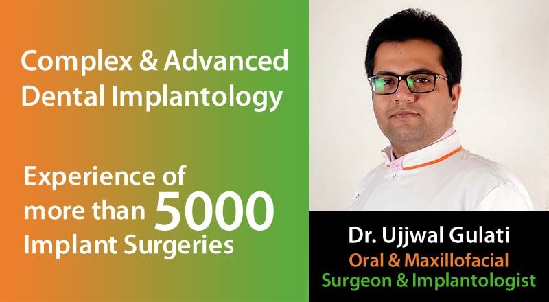 Complex and Advanced Dental Implantology by Dr. Ujjwal Gulati - Surgeon & Implantologist
