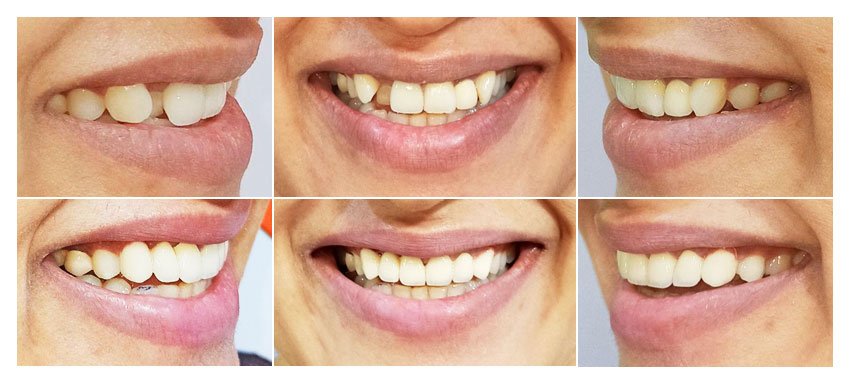 Smile Crafted by Dr. Ujjwal Gulati